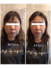 フフラ KANコルギセラピー山梨本店(fufla)/小顔ソムリエ　カーボキシー