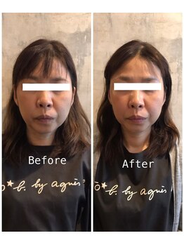 フフラ KANコルギセラピー山梨本店(fufla)/小顔ソムリエ　カーボキシー