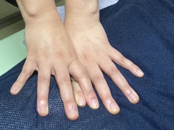 てもみラボ(てもみLABO)の写真/お身体の状態を見極め歪みを修正、腰痛を改善◎ずっと悩まされている辛さを改善し、快適な日常生活を♪