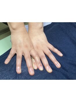 腰のつらさを改善したい