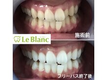 ルブラン 奈良店(Le Blanc)/お得なコースもございます！