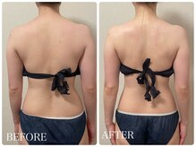 イリゼ(IRISER)/【20代ブライダル】1回の結果