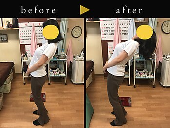 杉本接骨鍼灸院/若々しい背骨を取り戻す整体
