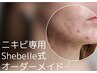 【ニキビケア悩み徹底相談】肌に合わせたオーダーメイドニキビケアピーリング