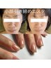 【小顔エステ&ネイル】低周波によるたるみケア ＋ジェルネイル同時 ¥13500