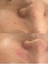 ジョワ 黒崎店(joie)/