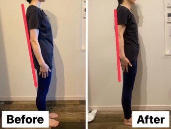 イオム ビューティワーク(IOM BEAUTY WORK)/後傾姿勢がまっすぐに!