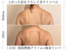 アルム(ALUM)/広がった肩甲骨を寄せて肩幅狭く