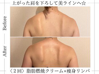 アルム(ALUM)/広がった肩甲骨を寄せて肩幅狭く