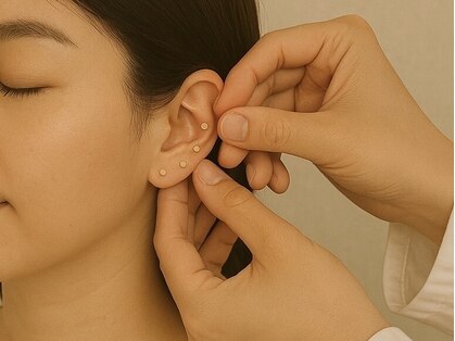 ムーン(MooN.)の写真