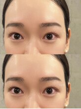 グロウ(Grow)/まつ毛パーマ【まつ毛/眉毛】