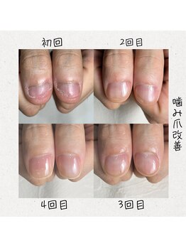 イズム(Izm)/53深爪育成/