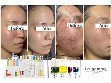 ラ ジェム(La gemme)