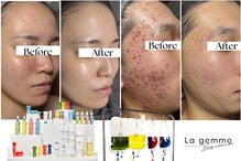 ラ ジェム(La gemme)