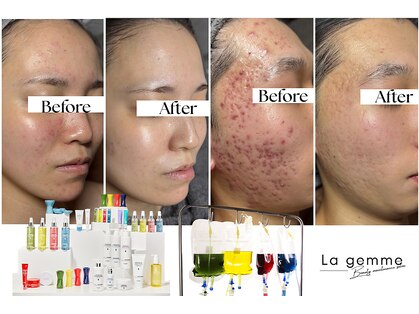 ラ ジェム(La gemme)の写真