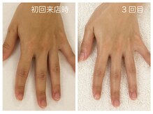 キレイテ 上野店/40代/3回目【ハンドケア上野】