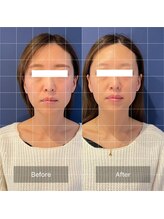 フフラ KANコルギセラピー山梨本店(fufla)/コルギ　小顔ソムリエ