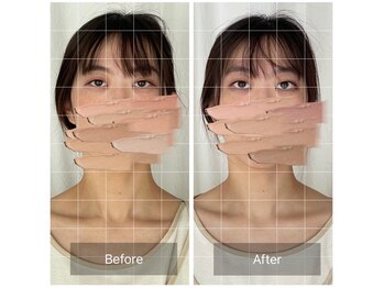 ティセ(TisseR)/脳洗浄100分