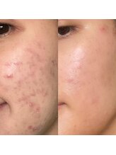 アイ クイーン 押上店(Eye queen)/