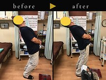 杉本接骨鍼灸院/若々しい背骨を取り戻す整体