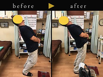 杉本接骨鍼灸院/若々しい背骨を取り戻す整体