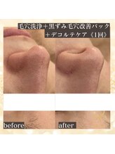 サロン カピリナ(salon Kapilina)/【before→after】