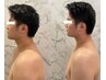 【美容鍼×肩こり・巻き肩】上半身90分フル調整★今だけ10,000円！