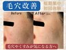 【平日限定クーポン】私の毛穴はどこいったプラズマ毛穴ケア♪