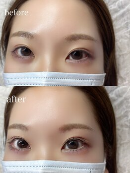 デュールイースト(Duul East)/まつげパーマ上下