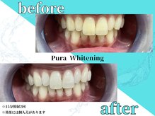 ピュアホワイトニング 横浜店の雰囲気（歯科提携セルフホワイトニングの驚きの白さを実感してください。）