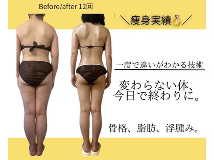 フォルスボーテ(Force Beaute)の写真