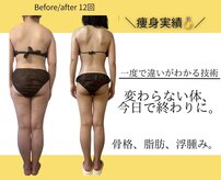フォルスボーテ(Force Beaute)