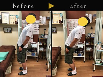 杉本接骨鍼灸院/若々しい背骨を取り戻す整体