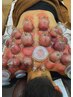 【むくみ改善】首肩集中カッピング40分¥4400