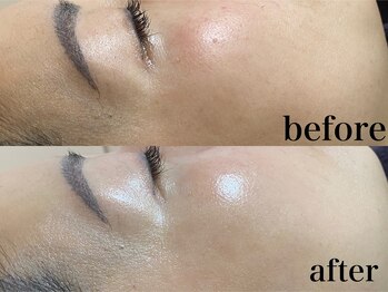 フェイシャルサロン アリイ(ALII)/