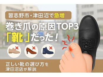 巻き爪じゅん 千葉駅前店/習志野市で多い「靴による巻き爪