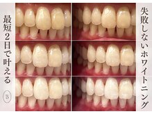 ブリエ(BRILLER)の雰囲気（【大人女性、男性に人気No1】医療提携ジェルを使用で圧倒的効果）