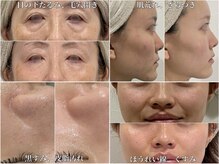 トリニティーベル(Trinity bel)