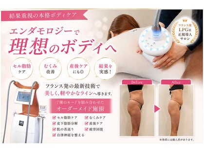 ミ ライト(m light)の写真