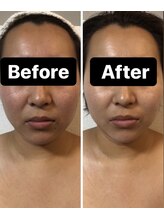 小顔コルギサロン シー(She)/【コルギ】1度の変化!