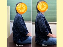 ナオル整体 大宮院(NAORU整体)/姿勢改善の【ビフォーアフター】