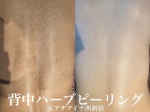 ルアナアイナ(Luana Aina)
