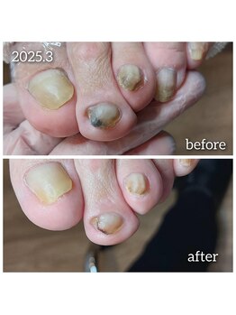 爪切り屋 足楽/