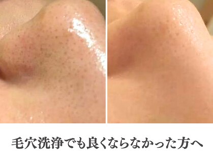 アクール(Accueil)の写真