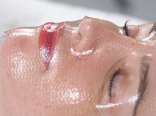 フューチャーズ ミィー(futures mii)/セラピール☆ゲルマスク