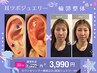 鍼が苦手！☆彡耳ツボジュエリー（10粒）＆すっきり輪郭整体