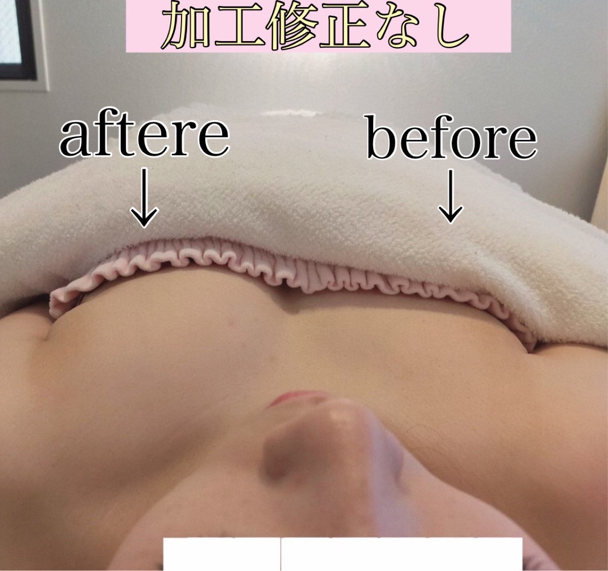 ビルーチェ(BELUCE)の写真/脂肪移動、癒着剥がし、日本での導入は当店のみのバスト機器でエステでも豊胸が可能です。