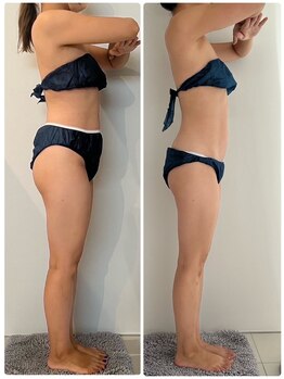 エムプリュ 心斎橋店(M.plus)/ハイパーナイフって本当にすごい