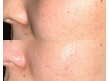ル シーニュ/頬の毛穴