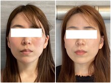 美容整体ウェリナ あま甚目寺院/小顔矯正/骨盤矯正/美脚サロン